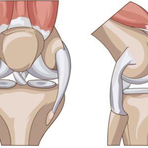 Fisioterapia per protesi al ginocchio a domicilio