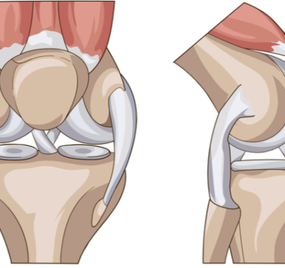 Fisioterapia per protesi al ginocchio a domicilio