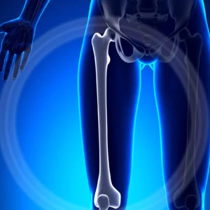 Qual è l’efficace fisioterapia per frattura al femore?