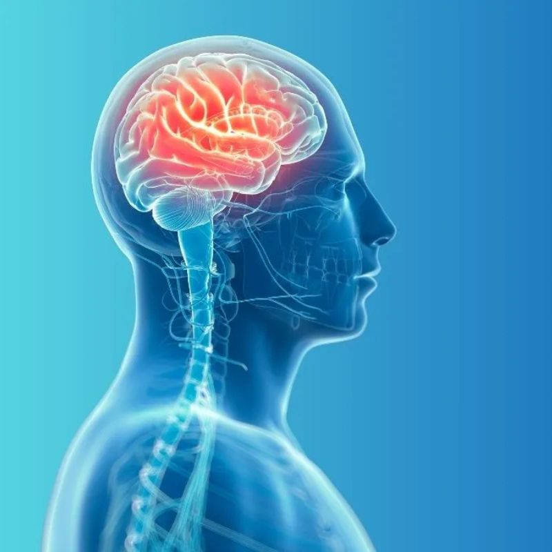 riabilitazione post ictus